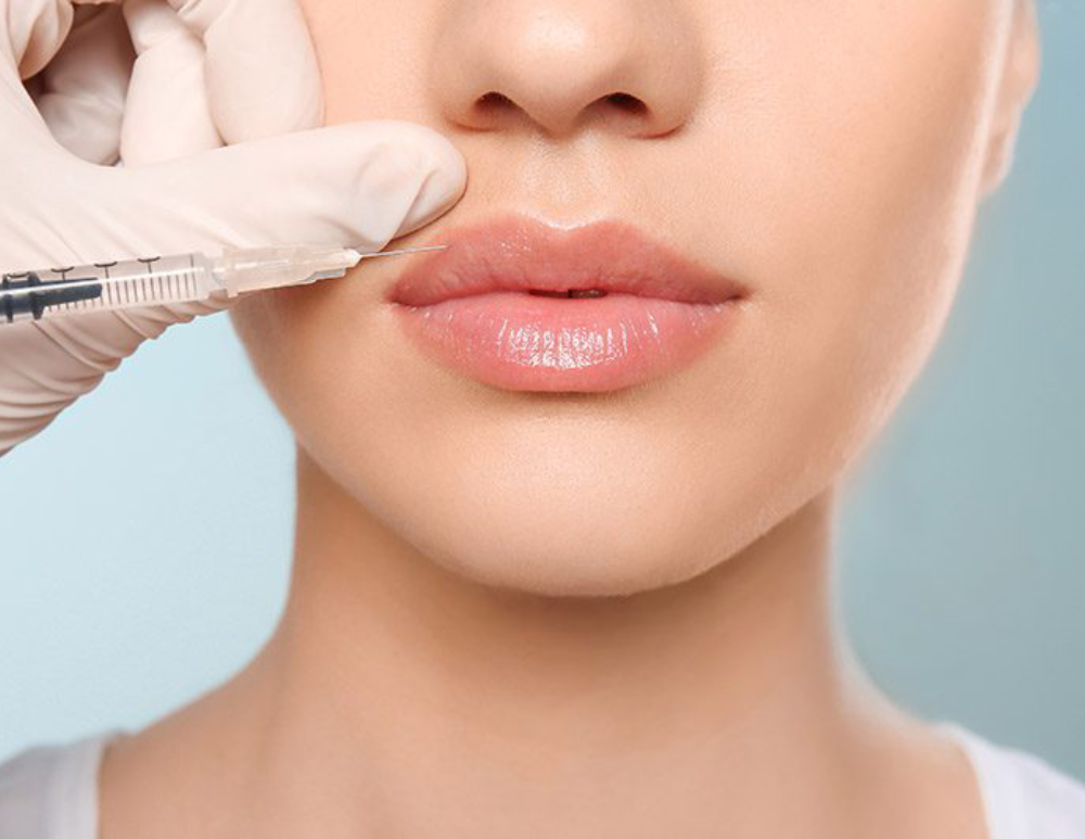 Dermal-Fillers