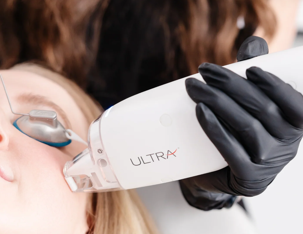 Ultra-LaseMD