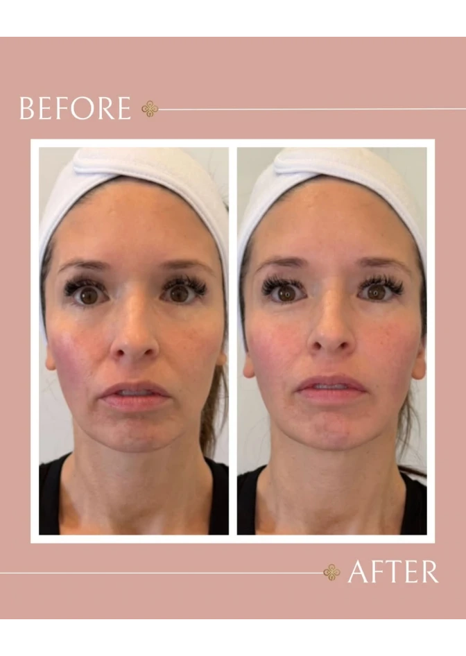 before-after-01