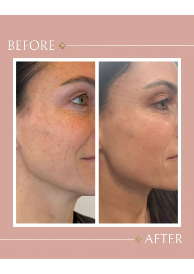 before-after-02