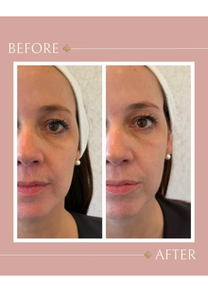 before-after-03