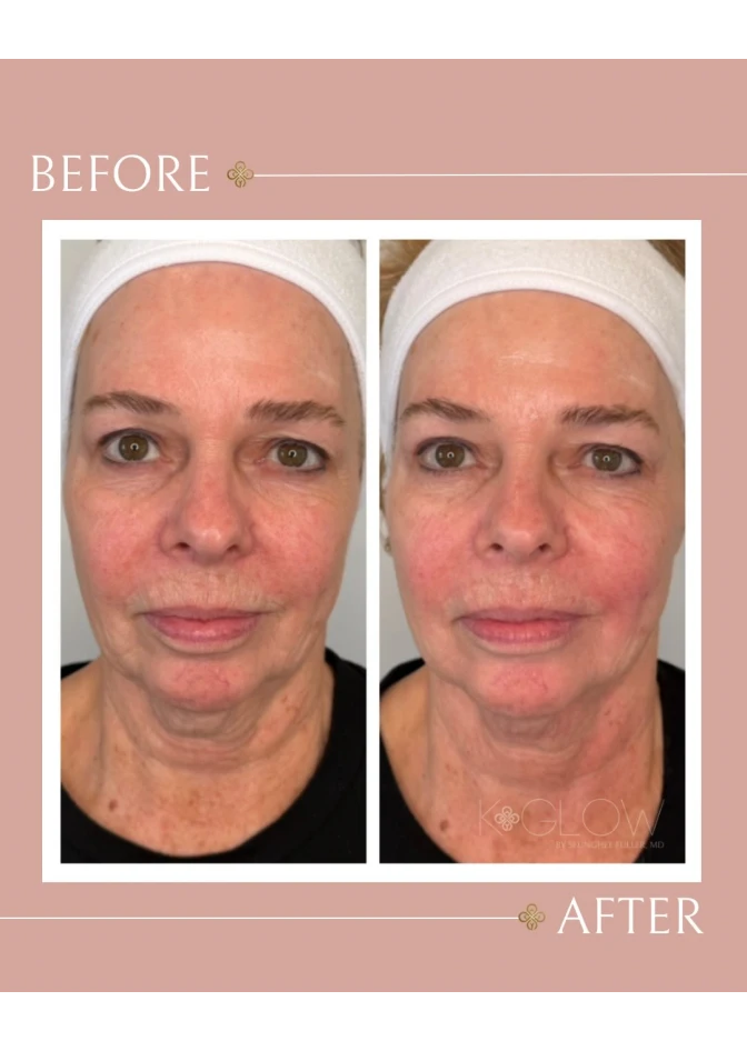 before-after-04