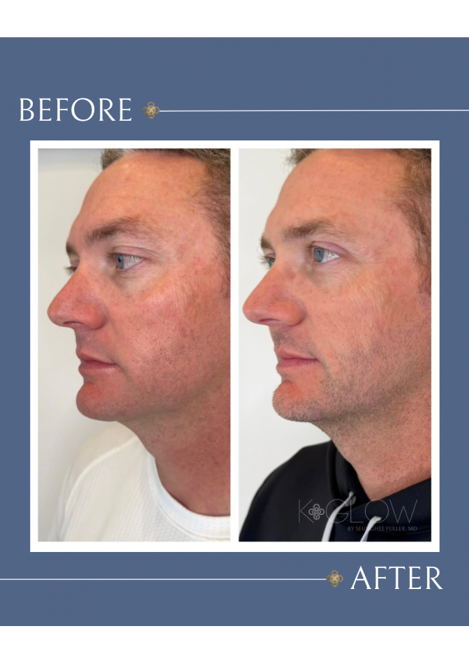 facial-for-men-treatment