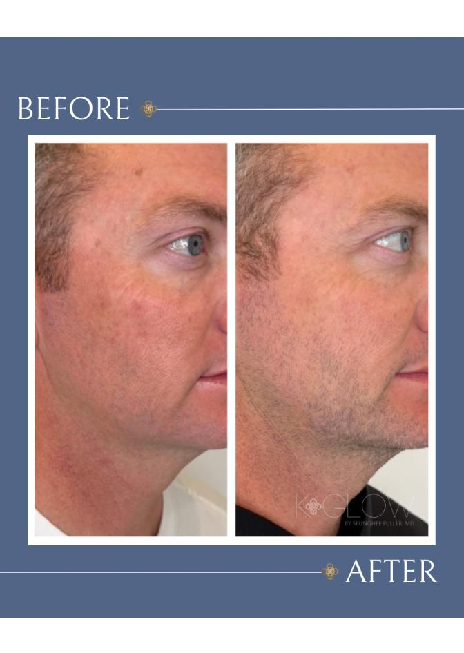 men-med-spa-treatment