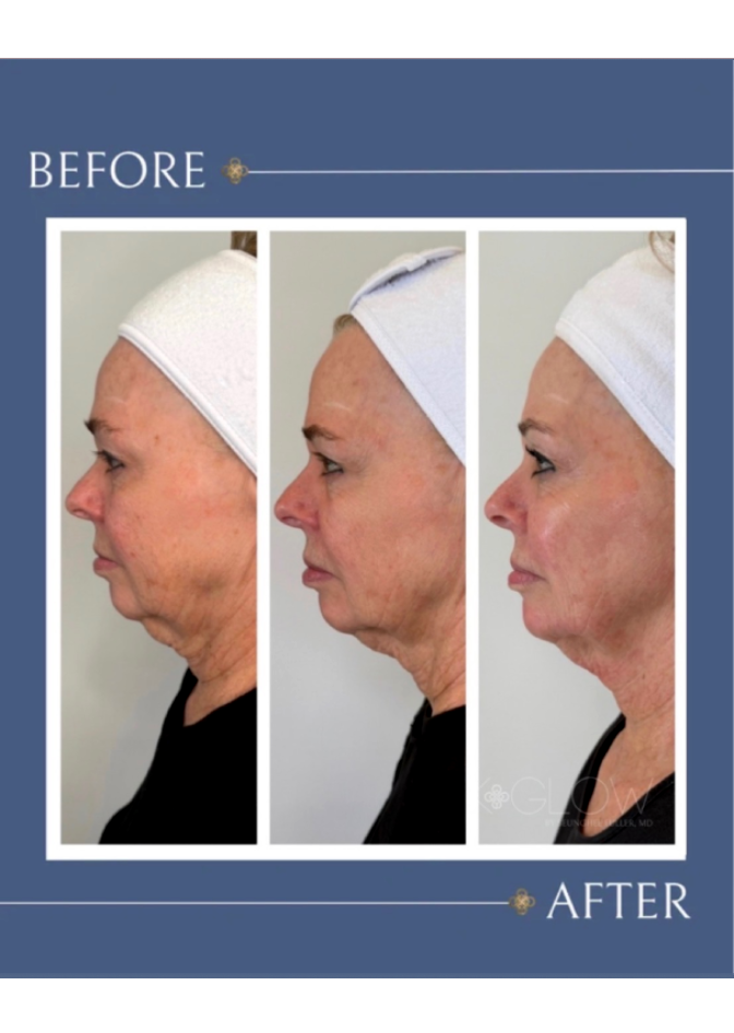 same-day-med-spa-services