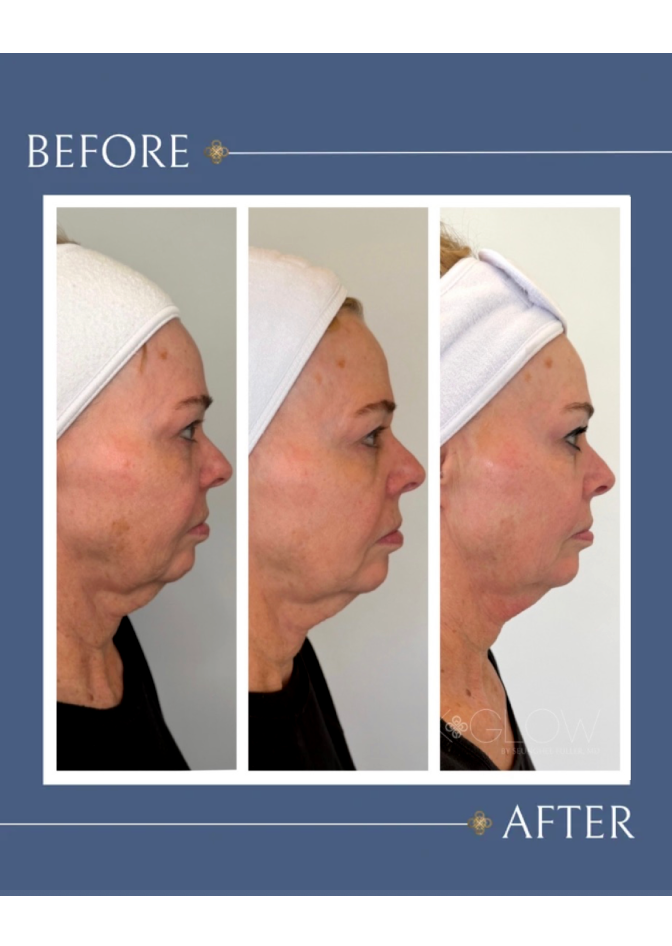 women-treatment-before-and-after
