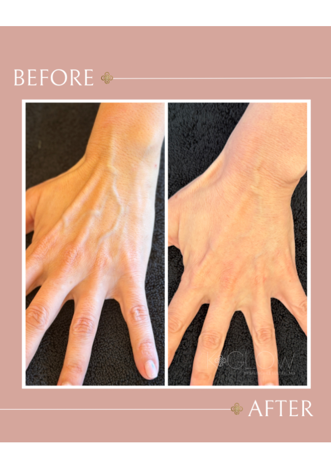 top-med-spa-treatment