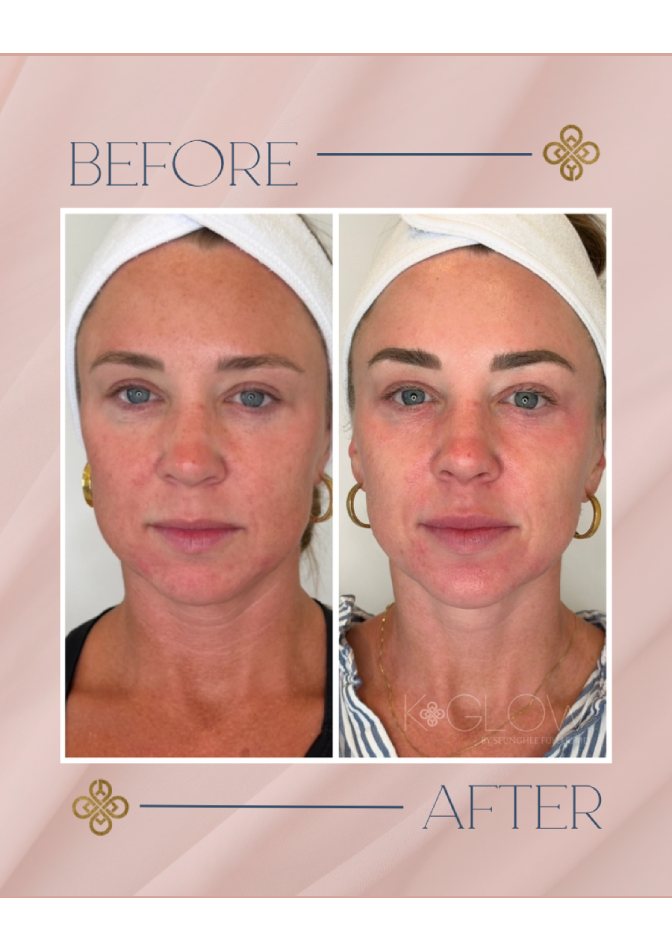 top-med-spa-treatment (1)