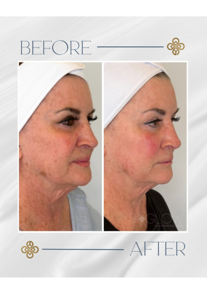 top-med-spa-treatment (2)