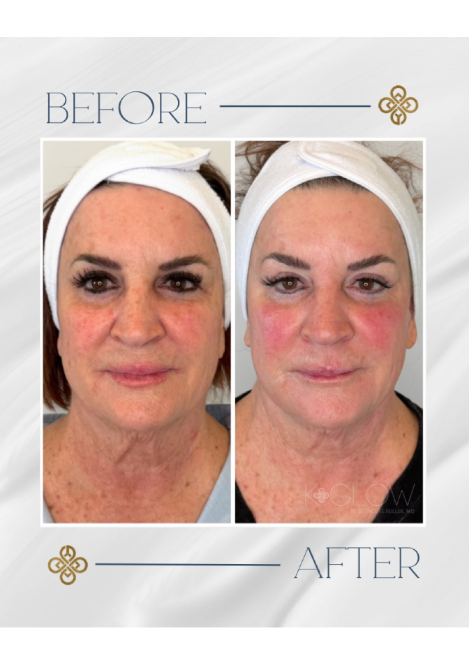top-med-spa-treatment (2a)
