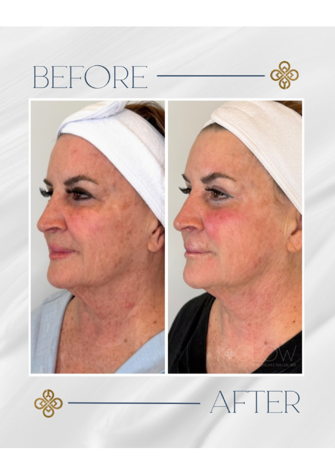 top-med-spa-treatment (3)