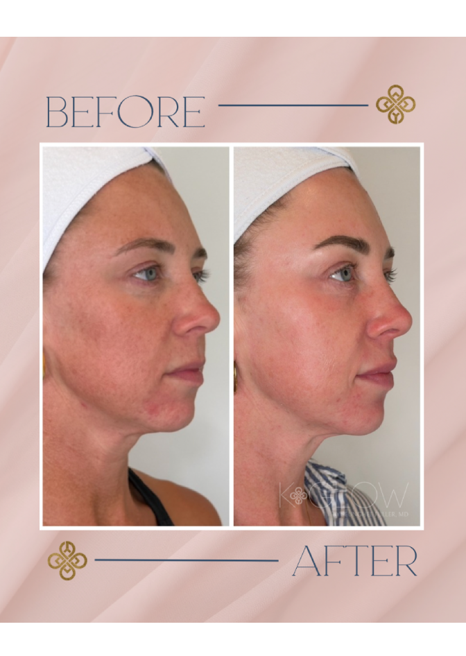 top-med-spa-treatment (4)