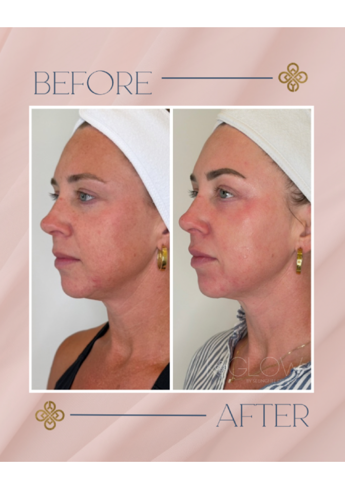 top-med-spa-treatment (5)